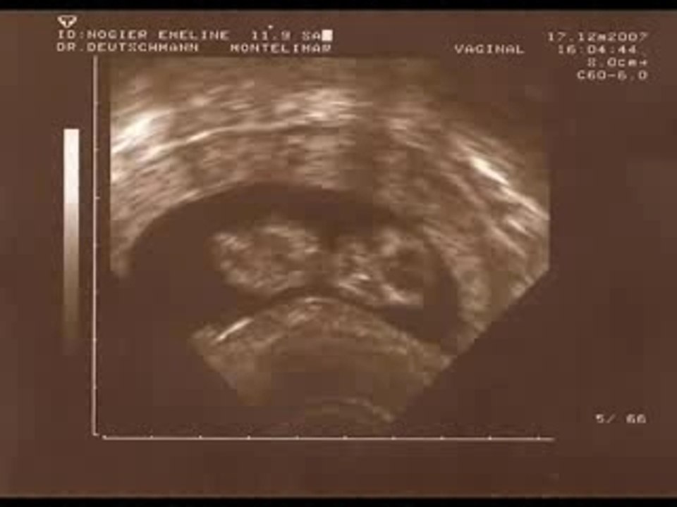 Vidéo bebe