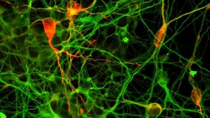 Soigner Parkinson grâce aux cellules souches