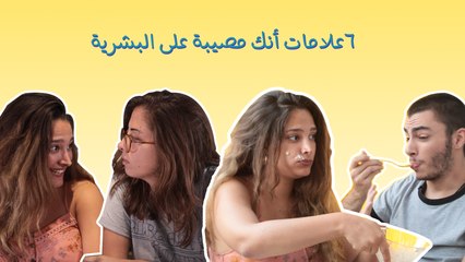 ٦ علامات أنك مصيبة على البشرية: إعمل نفسك ميت