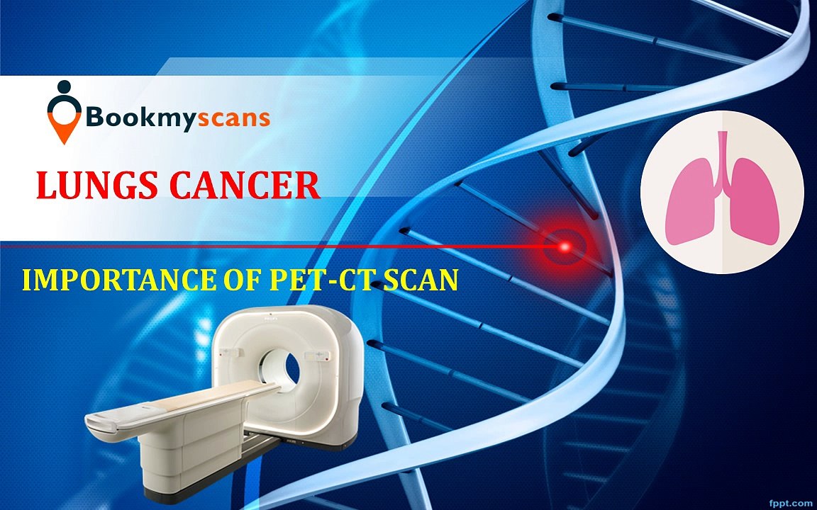 Importance of PET-CT scan in Lungs Cancer