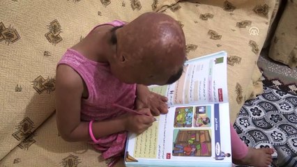 7 yaşındaki Evin'in geçirdiği 93 ameliyat savaşın izlerini silemedi - BATMAN