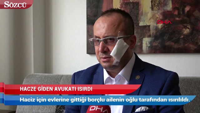 Hacze giden avukatı bu hale getirdiler