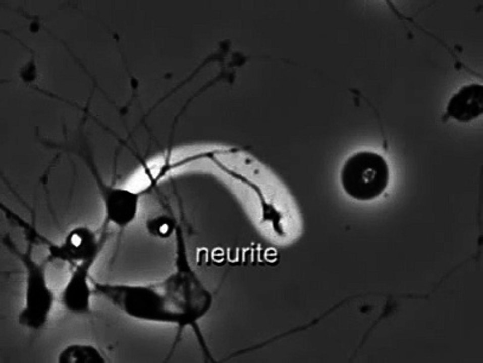 12.10 Neurite Outgrowth