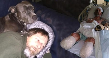 ABD'li Adam, Köpeğinden Kaptığı Bakteri Yüzünden Ellerini ve Bacaklarını Kaybetti