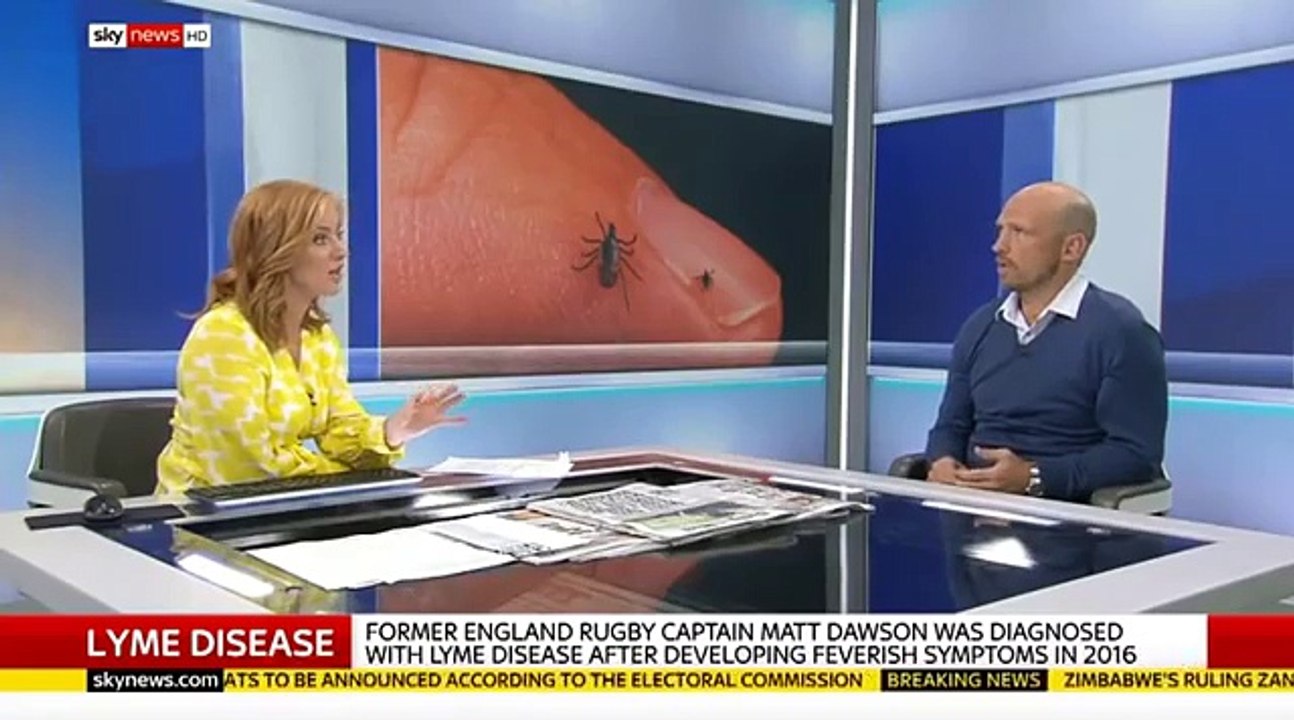 Matt Dawson "It's a little bit tricky day-to-day." - Sky News 01-08-2018