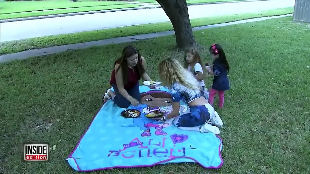 Miracle Girls Born With Hearts Beating Outside Chest Meet For First Time