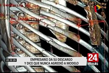 Empresario acusado de agresión denunciará a expareja por difamación