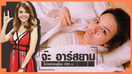 จ๊ะ อาร์สยาม บอกลาอกแบนราบ ได้หน้าอกคู่ใหม่ 400 ซี.ซี. อึ๋มอย่างใจต้องการ
