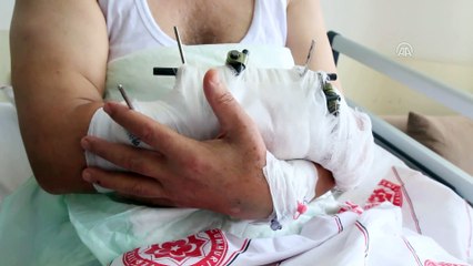 Ayıların saldırısından nacak sayesinde kurtuldu - SİVAS