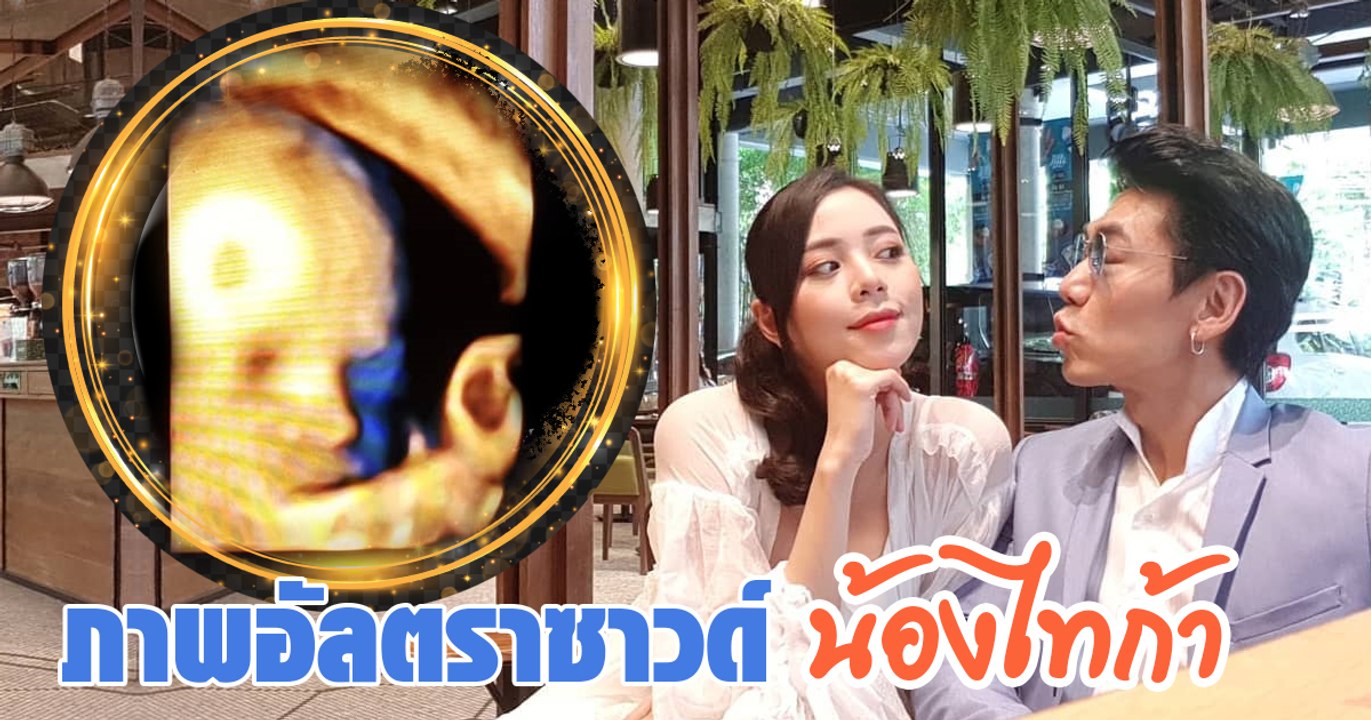 เผยภาพอัลตราซาวด์ น้องไทก้า ลูกคนแรก เพชรจ้า - นิวเคลียร์