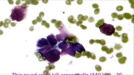 This sound could kill cancer cells (440 Hz) - 30 minutes of treatment