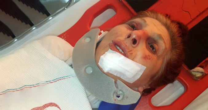 Antalya'da, Yaşlı Kadına İşkence Yapıp Gasp Eden Maskeli Soyguncular Yakalandı