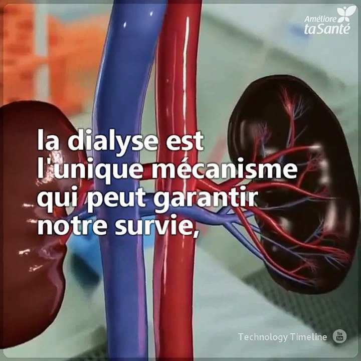 Toutes les personnes en attente d'un rein et placées sous dialyse voient un nouvel espoir dans une innovation récente : des reins artificiels greffables. Le risque de rejet est très faible. Une grande nouvelle !