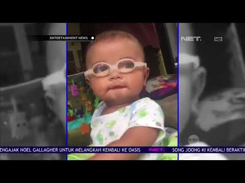 Kesedihan Asri Welas Saat Anaknya Mengidap Katarak