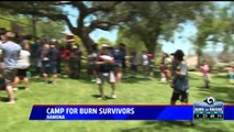 Dozens of Young Burn Survivors Attend 'Camp Beyond the Scars'