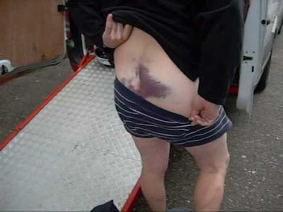 When wheelies go bad