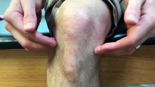 Knee Pain Types Explained - Royersford, PA - Limerick, PA