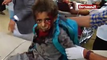 غارة استهدفت حافلة تقل أطفالا بمحافظة صعدة