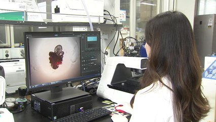 인간 소장과 비슷한 '장기 유사체' 성숙화 기술 개발 / YTN