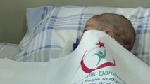 Kalp Damarları Ters Olan Bebek, Ameliyatla Sağlığına Kavuştu