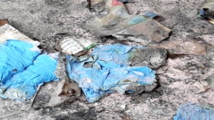 택배 상자 폭발 근로자 2명 화상 / YTN