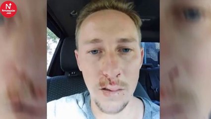 The Dangerous Reason Why Not to Drink Cold Water on a Hot Day