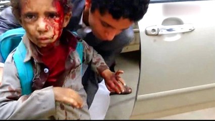 'Didn't find any remains': Yemen's survivors on deadly bus attack