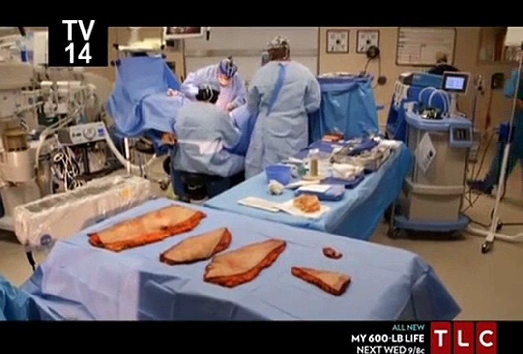 Skin Tight S01 E04