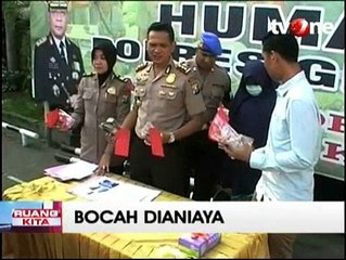 Pakai Kuteks, Bocah TK Dianiaya Sang Tante