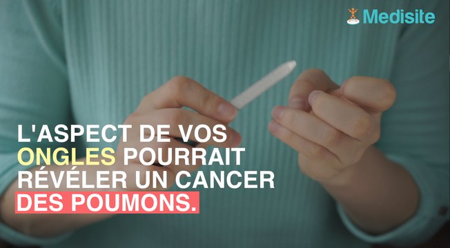 Ses ongles abîmés permettent de révéler un cancer des poumons