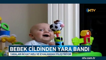 Devrim niteliğinde buluş (Bebek cildinden yara bandı)