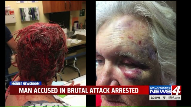 Masked Man Accused of Hiding Inside Barn, Attacking Elderly Woman with Shovel