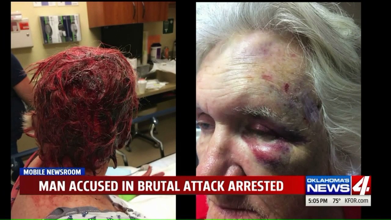 Masked Man Accused of Hiding Inside Barn, Attacking Elderly Woman with Shovel