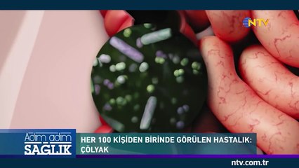 Adım Adım Sağlık 21 Nisan 2018