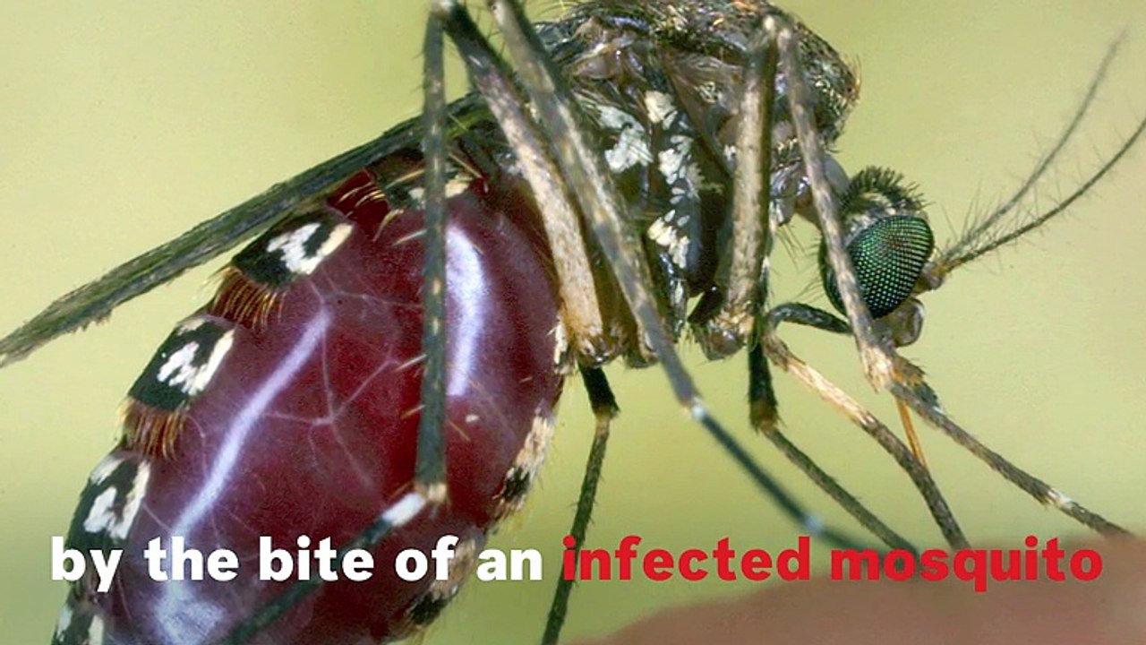 What Is La Crosse Encephalitis?