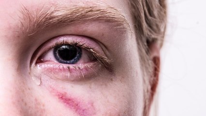 Crying Health Benefits: रोने के ये फायदे जानकर हो जाएंगे हैरान | Boldsky