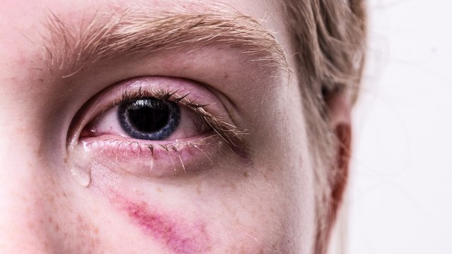 Crying Health Benefits: रोने के ये फायदे जानकर हो जाएंगे हैरान | Boldsky
