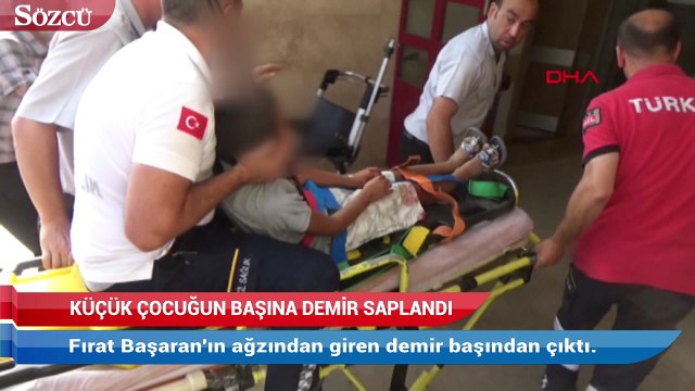 Bisikletten düşen çocuğun başına inşaat demiri saplandı