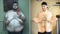 My 300lbs Weight Loss Left Me With 13lbs Of Loose Skin