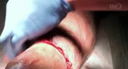 Benidorm ER S04 - Ep06  6 HD Watch