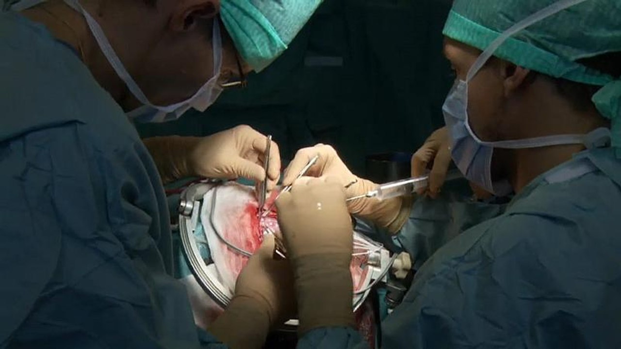 Erstmals in Europa: Mit Laser gegen Epilepsie