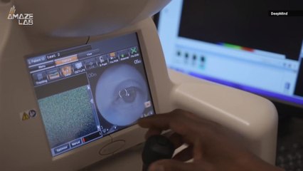New AI Can Detect Eye Disease Just As Well As World's Top Doctors