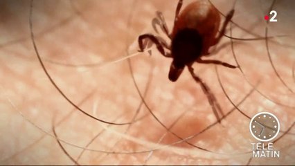 Santé - Maladie de Lyme : comment se protéger et s’habiller ?