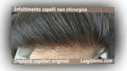 Protesi capelli per uomo e donna a Fiumicino Aprilia Pomezia Tivoli Anzio di LuigiUomo. Le migliori per qualità durata e prezzo.