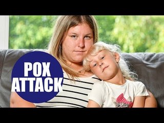 Six-year-old girl left almost paralysed after suffering from CHICKENPOX