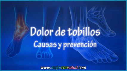 Dolor de tobillos causas y prevención