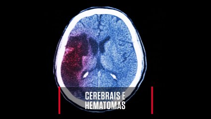 OS MÉDICOS SERÃO SUBSTITUÍDOS POR ROBÔS?