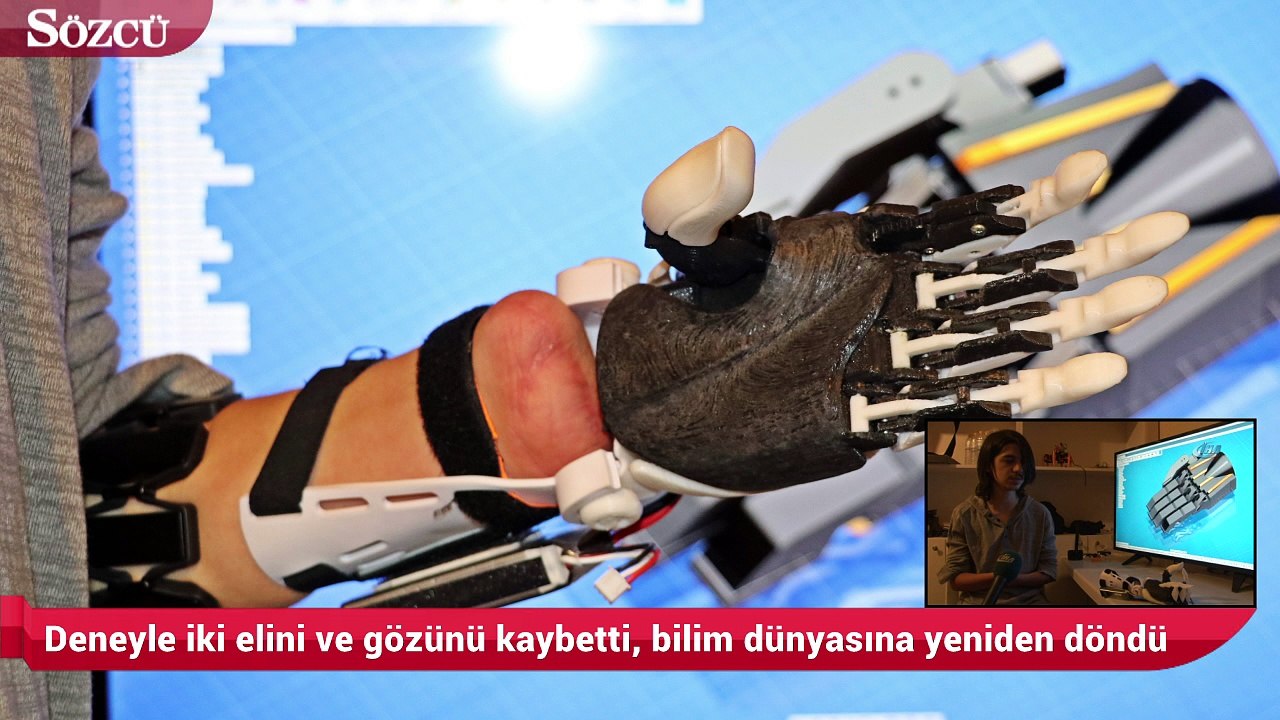 Deneyle iki elini ve gözünü kaybetti, bilim dünyasına yeniden döndü