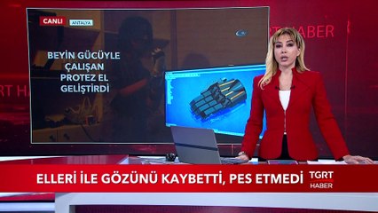 Elleri İle Gözünü Kaybetti: Beyin Gücüyle Çalışan Protez El Geliştirdi!