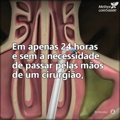 A sinuplastia com balão é uma intervenção simples e rápida para quem sofre de